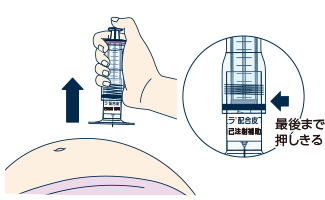 プランジャーを最後まで押しきり、薬液を全量注入したことを確認した後に、注射針を刺した角度と同じ角度で抜きます。